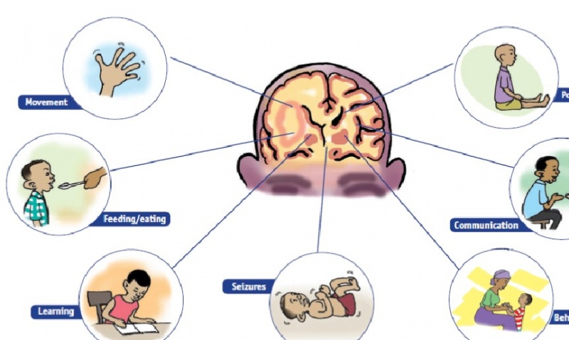 Cerebral Palsy